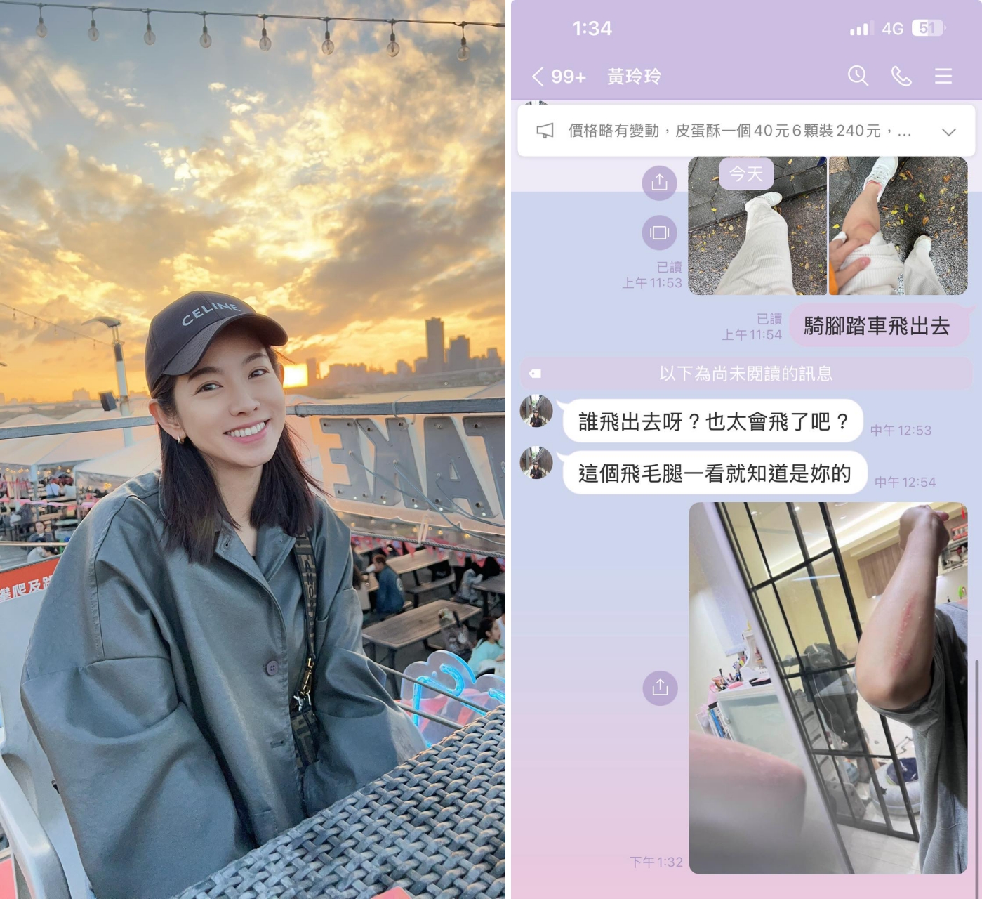 米可白雨天騎腳踏車受傷，媽媽回應很生動。（翻攝臉書）