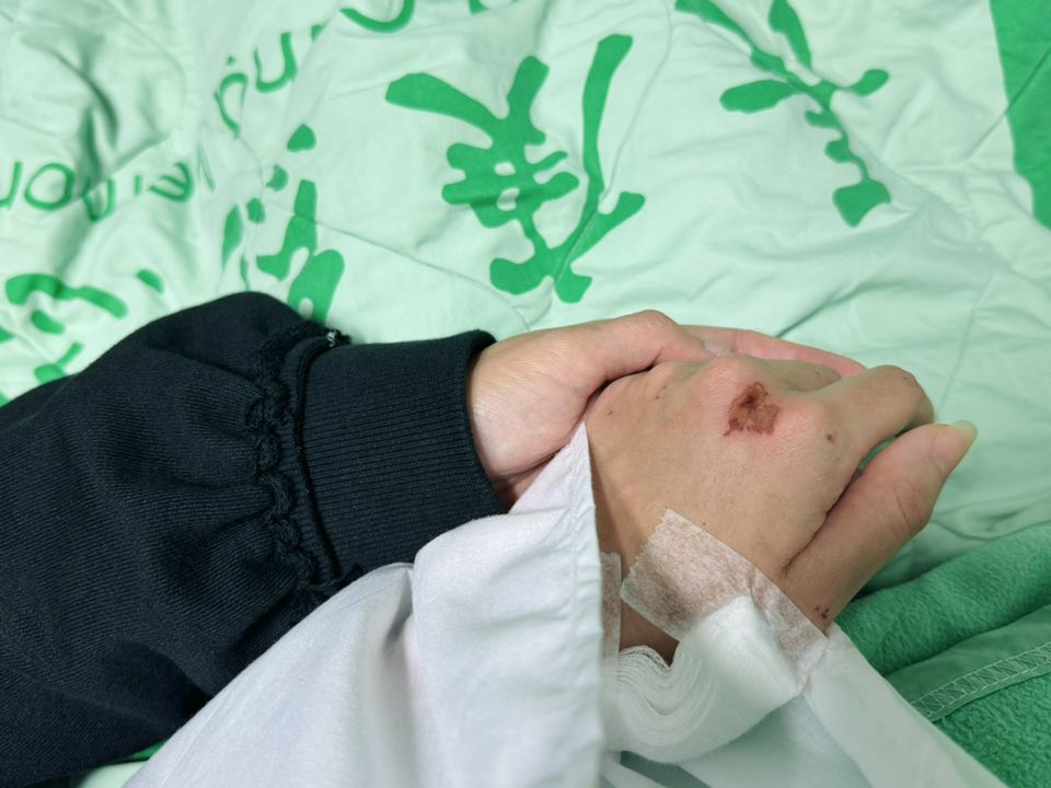 顏曉筠在臉書分享受傷心情。(翻攝臉書)