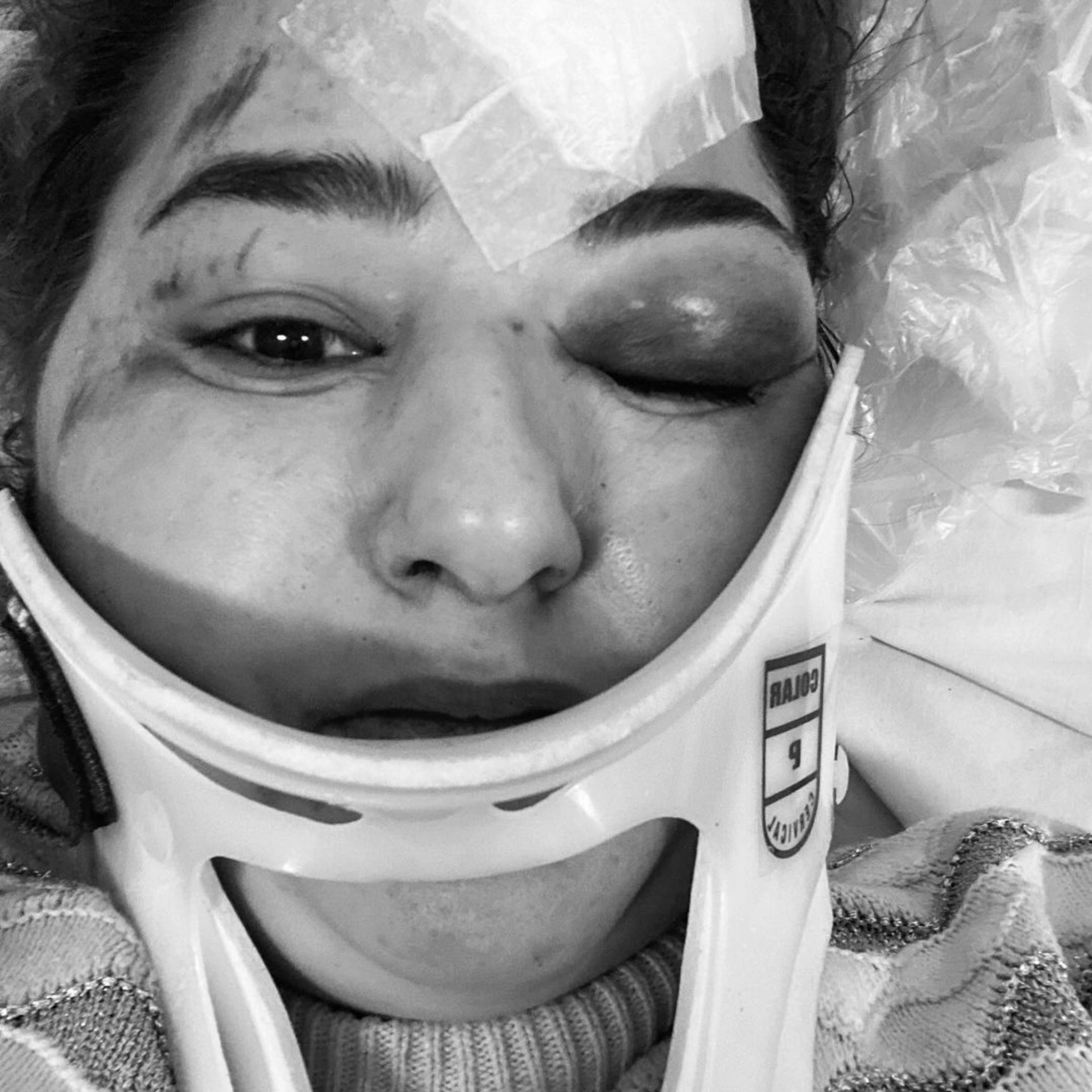  巴西女「被甩飛座位」重創險死。（翻攝IG）