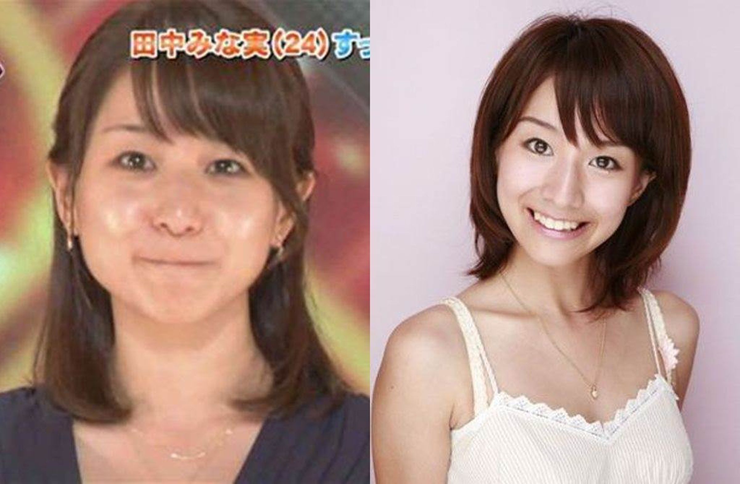 田中美奈實臉蛋成長史被挖出,掀起整形討論。(翻攝自日網)