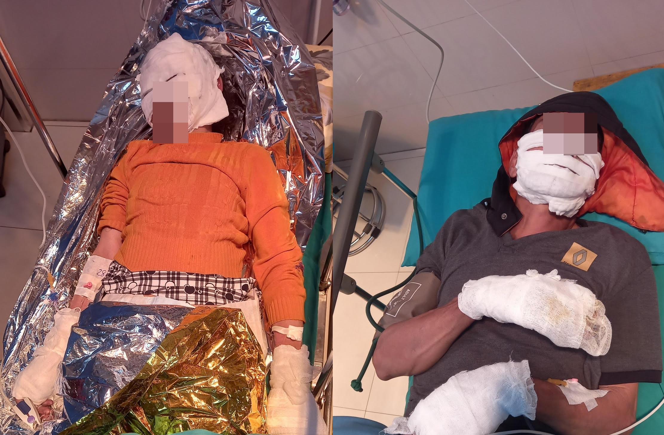 這對夫妻因手機爆炸嚴重燒傷，被緊急送醫急救。（翻攝雄王醫院臉書）