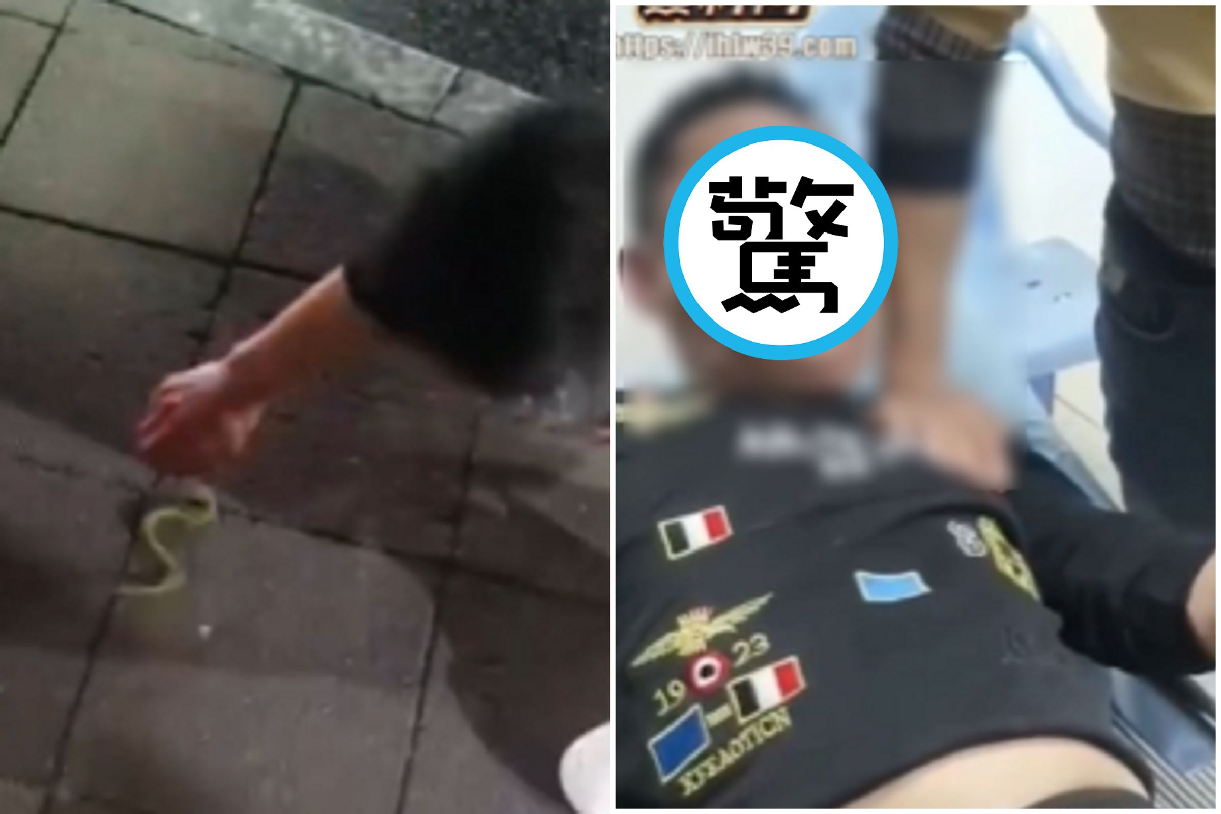 慎入!男逞強捉小青蛇下場慘了,全臉腫成「大頭佛」狀況不妙。(翻自《黑料網》)