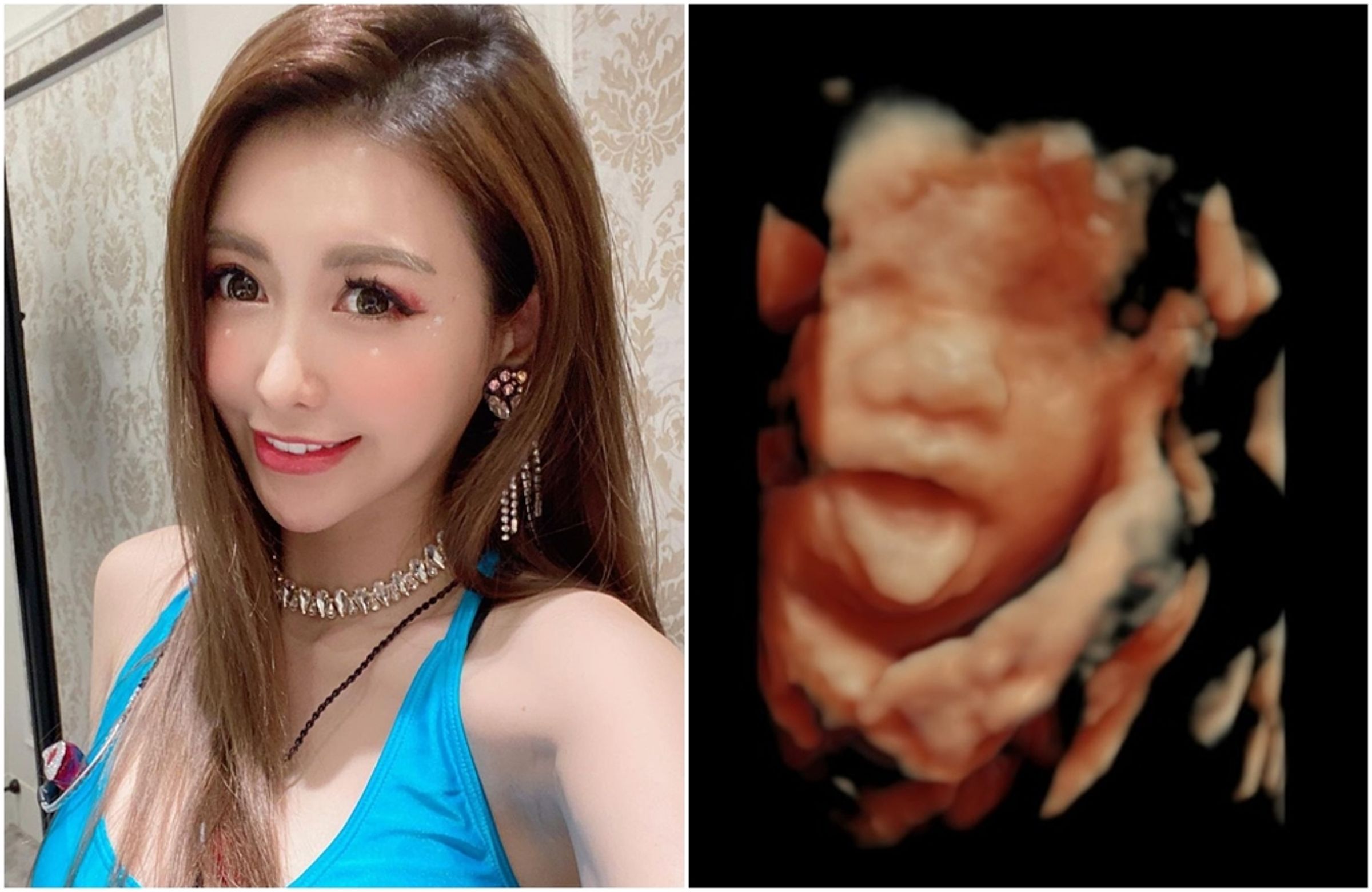 愷樂日前分享超音波照,今天更是發文證實已生下兒子。(翻攝自愷樂IG)