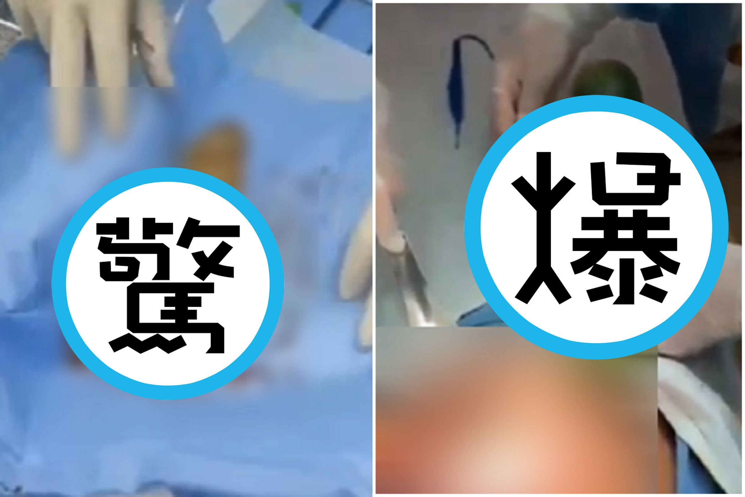 性玩具有風險要「慎入」！超越30公分巨棒黃瓜塞體內，「突破子宮」太恐怖。（翻自《黑料網》）