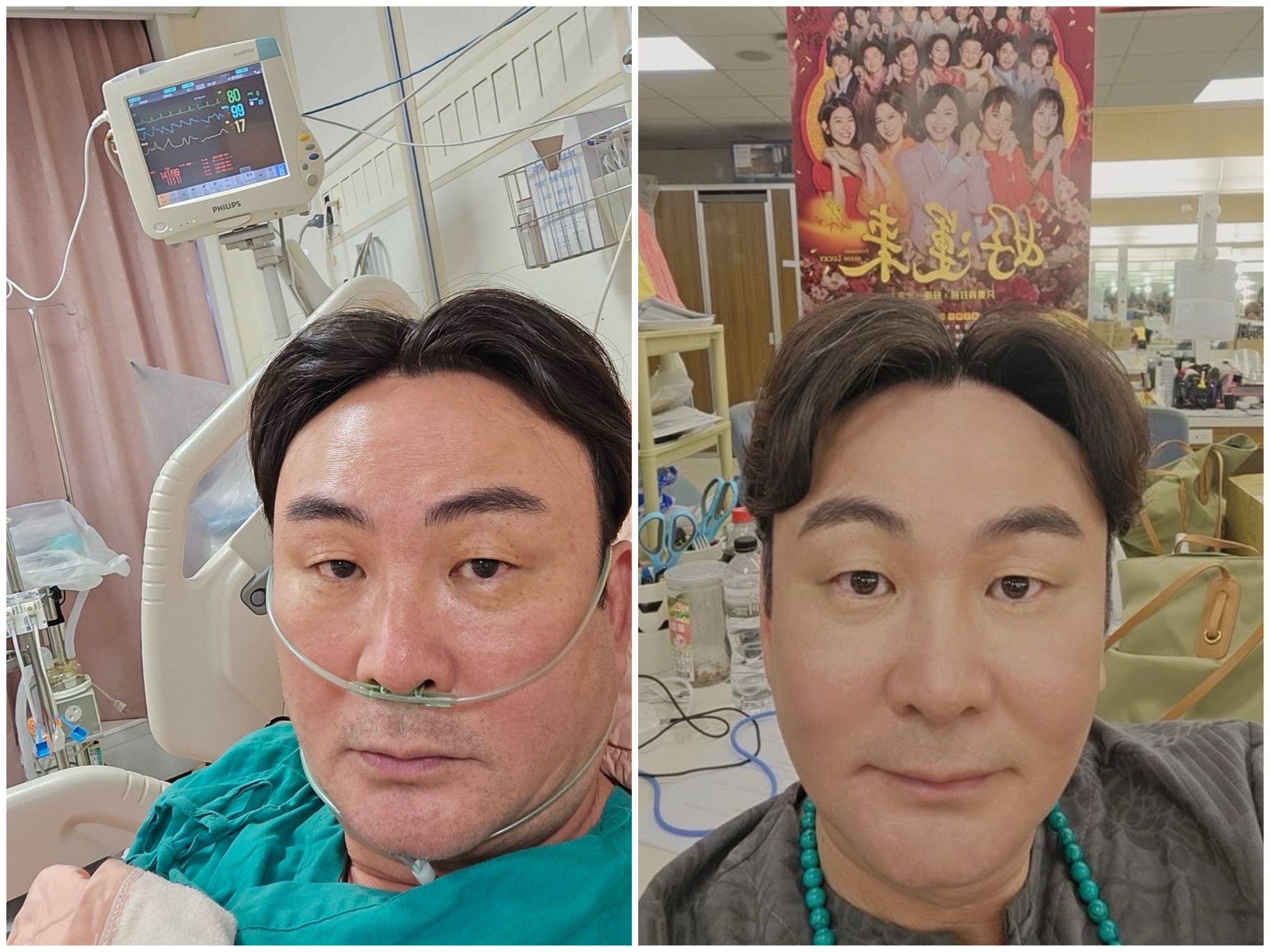 八點檔演員洪毛因爆肝住院，情況一度危急。（民視提供）