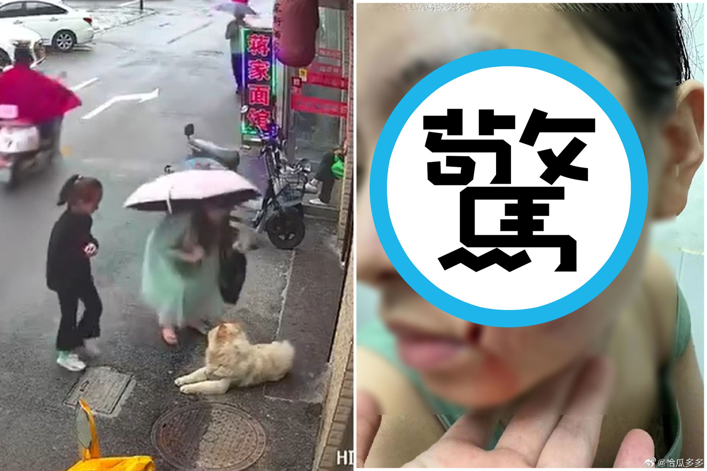 「狗勾好可愛摸一下」，人妻慘遭硬上狠咬嚴重破相。（翻自微博）