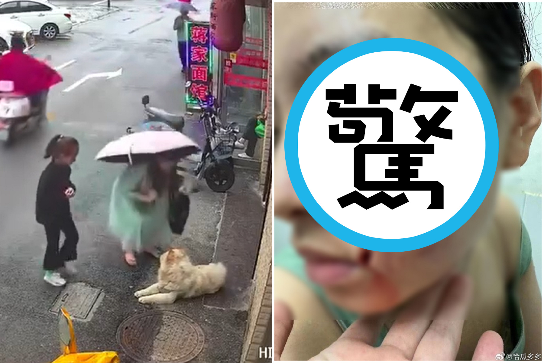 「狗勾好可愛摸一下」，人妻慘遭硬上狠咬嚴重破相。（翻自微博）