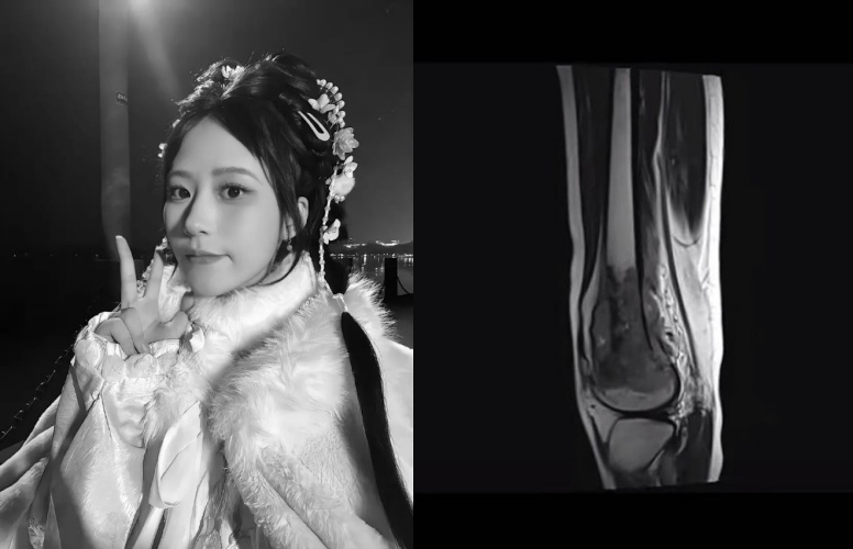 中國抗癌網紅呆呆羊生前抗癌5年，病床上的她仍不忘鼓勵其他病友勇敢活著。（翻攝自抖音 @呆呆羊）