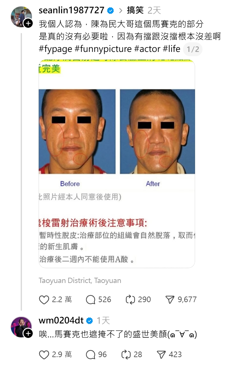 一張醫美照片近日在社群瘋傳,許多人都猜到當事人身分,陳為民本尊也親自回應了。 (翻攝自Threads)