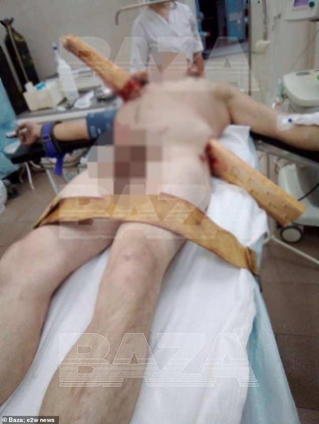 尼可拉身體被大塊木板貫穿。（翻自《每日郵報》）