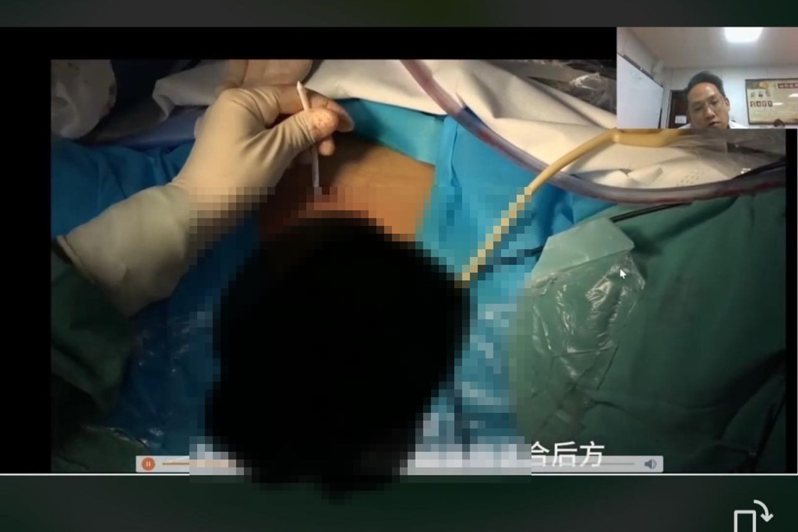 5萬人湧入看!中國醫院手術「無碼直播」女患者私處 網怒檢舉:太離譜!