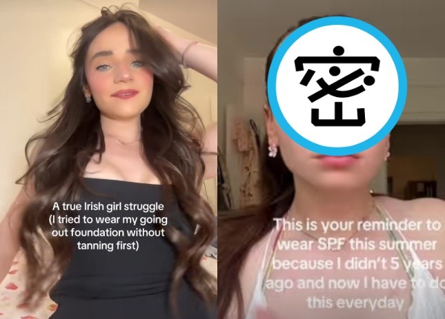 這名女子坦言「小丑紅鼻」讓她自信心幾乎被摧毀，不敢素顏外出，生活充滿壓力。（翻攝自tiktok @jess.mcgirr）