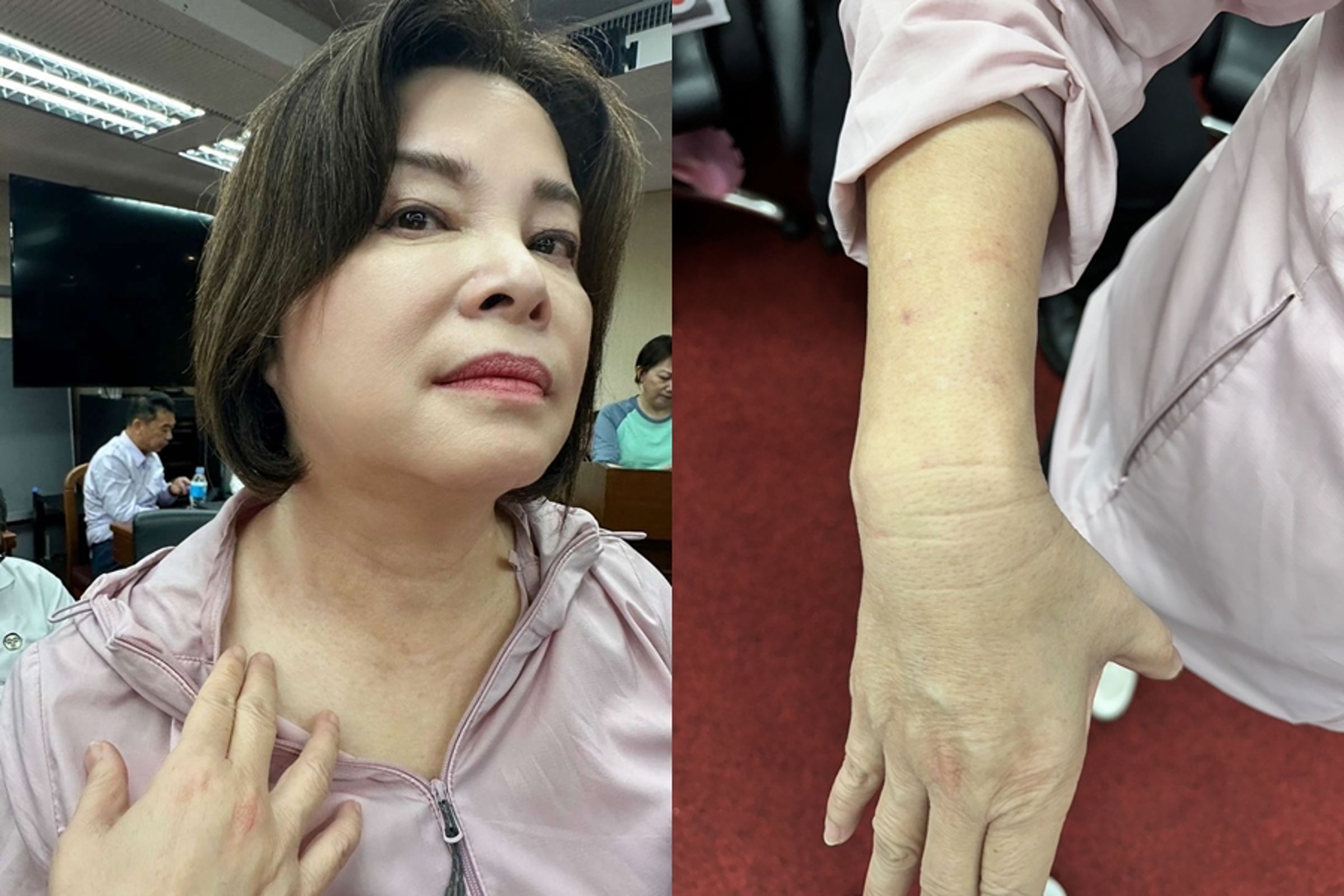 綠委賴惠員今在臉書發文，控遭藍委徐巧芯勒脖與抓傷。（翻攝自賴惠員臉書）