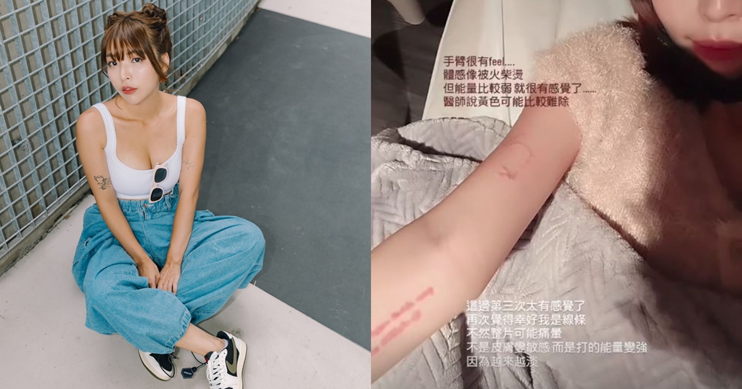阿圓手上有多個小圖微刺青，近期想把它們除掉。（翻攝自一隻阿圓IG、臉書）
