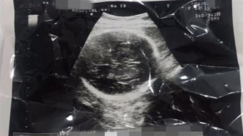 權姓女子原想記錄墮胎心路歷程，卻意外揭發一場殘酷的殺嬰慘劇。（翻攝自權女YT）