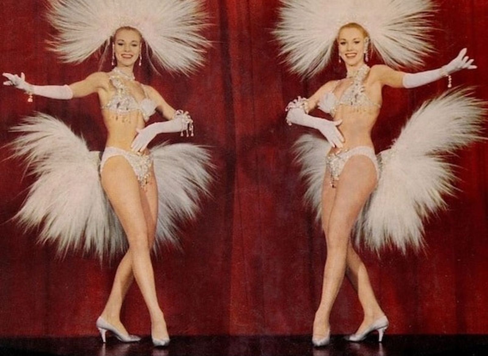 永不分離!「國家美腿」雙胞胎安樂死 曾登花花公子封面創銷售紀錄