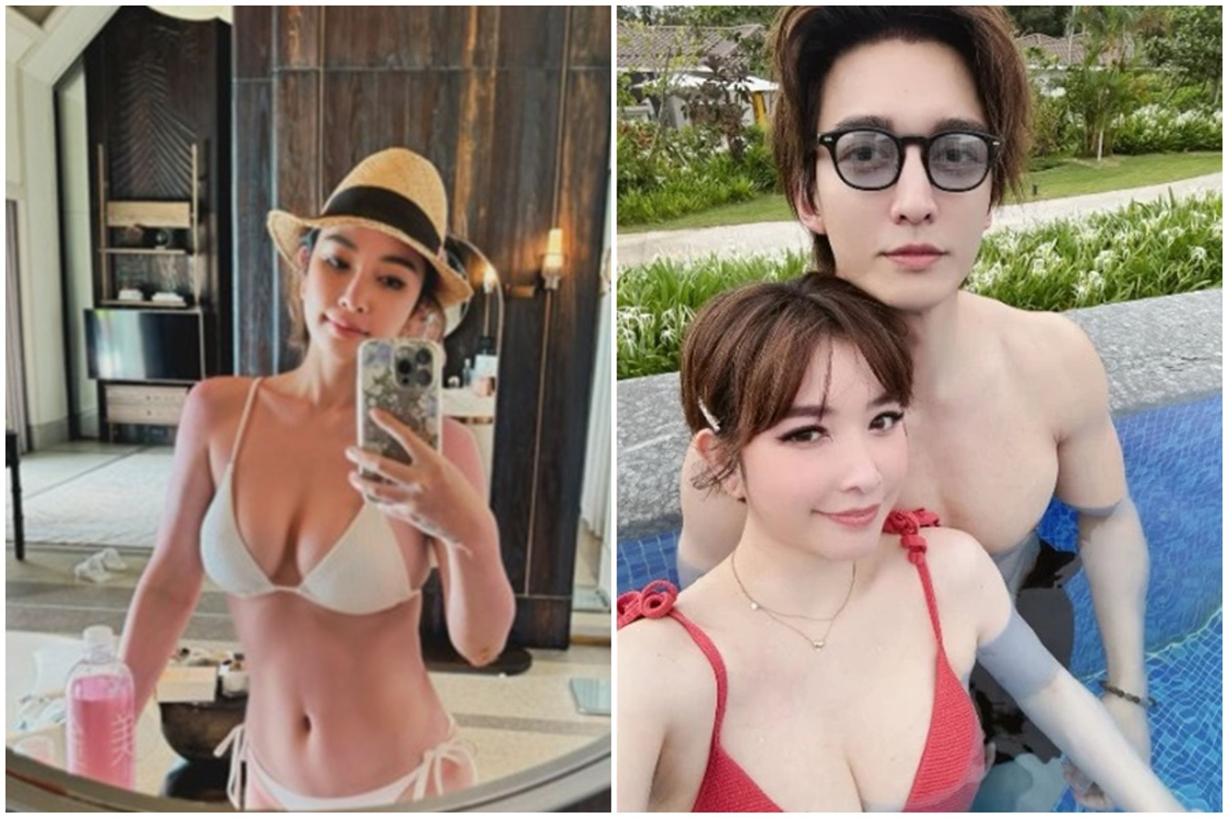 許維恩表示因單邊確診早期乳癌，雖未有家族病史，但考量未來風險，選擇進行雙邊切除與重建。（翻攝自許維恩IG）