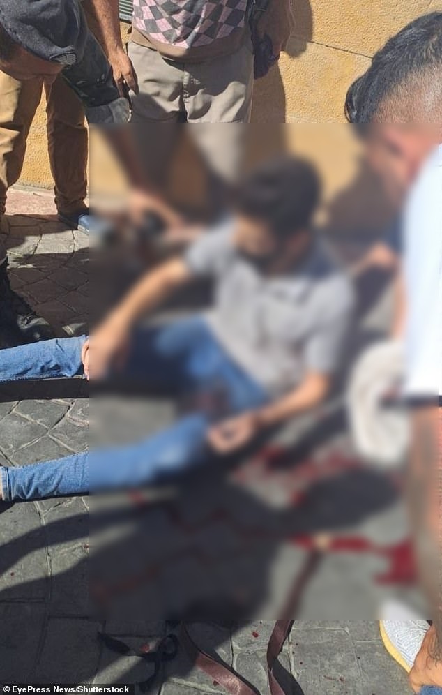 有人的下體被炸傷。(翻自《每日郵報》)