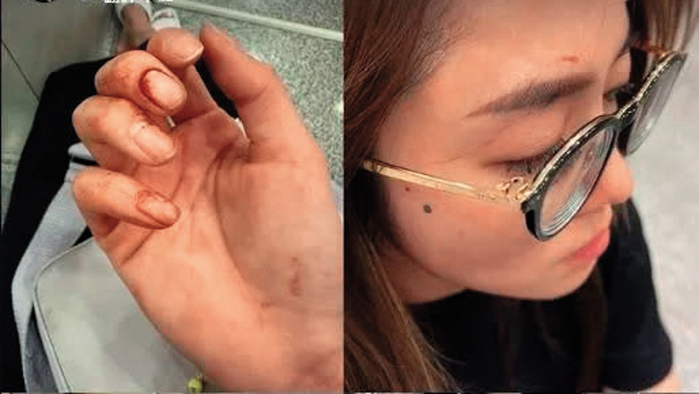 林千又遭賴姓富商家暴,拒絕暴力!先吃份納豆壓壓驚。(翻攝自林千又IG)