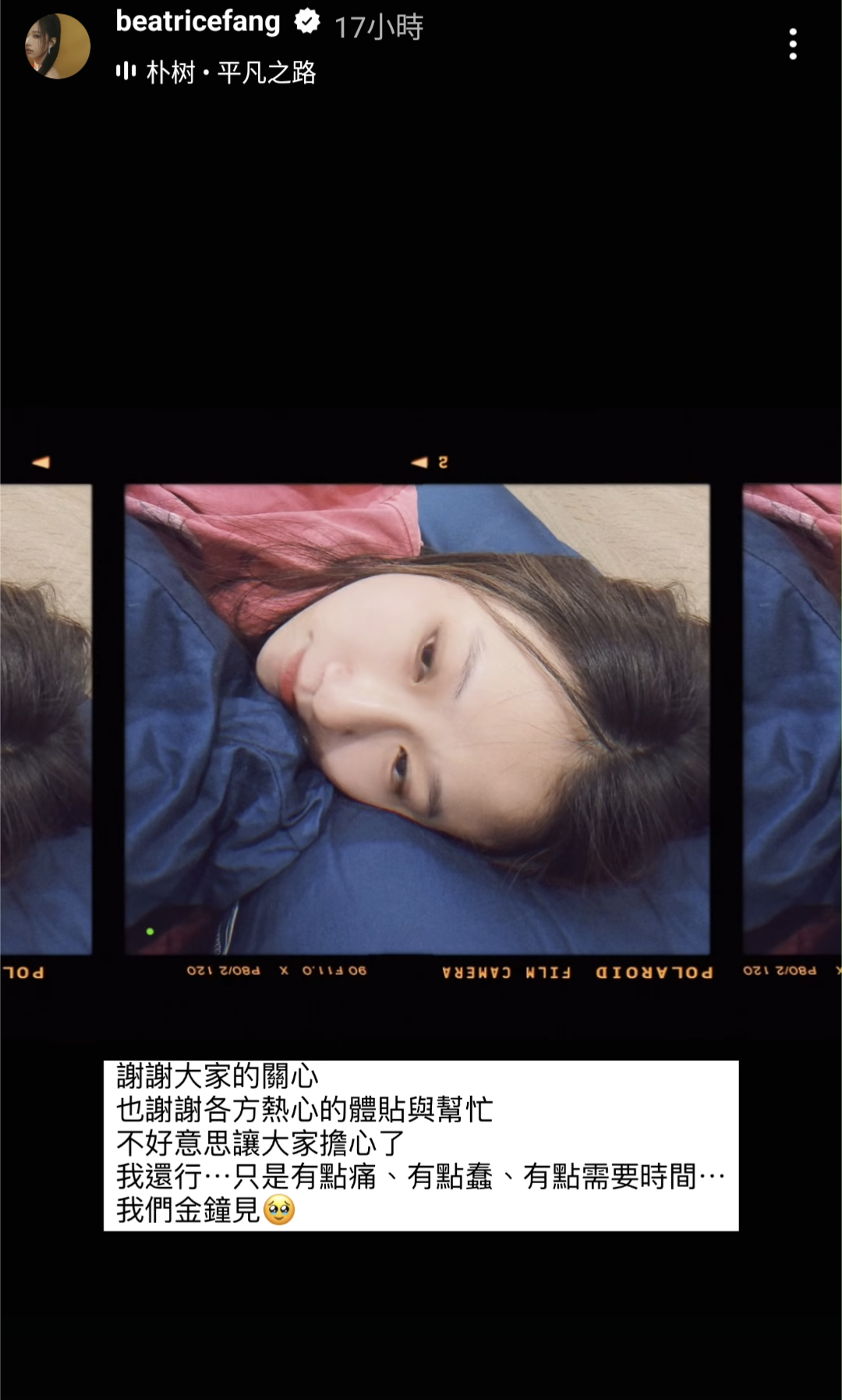昨天傳出方志友定裝時重摔受傷,她晚間曬出近況多謝外界關心。(方志友IG)