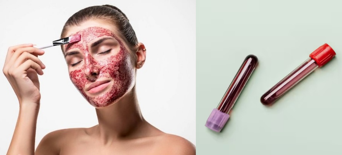 「經血面膜」在TikTok爆紅，但醫師提醒可能帶來感染與刺激風險。（翻攝自X）