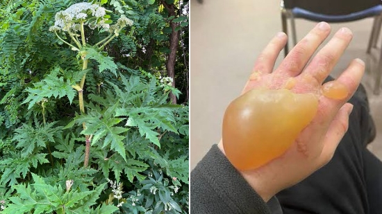 日本疑出現「世界最危險植物」大豕草。（翻攝自X）