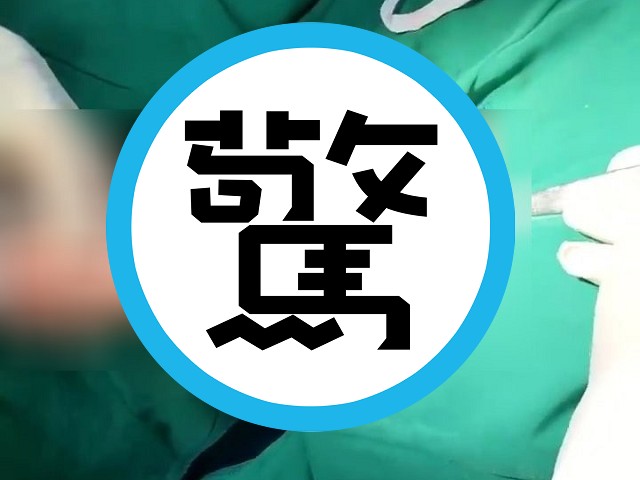 驚悚影片曝光！他把20公分異物插下體，「頂到直腸爆菊」嚇壞醫師。（翻自《青年報》）