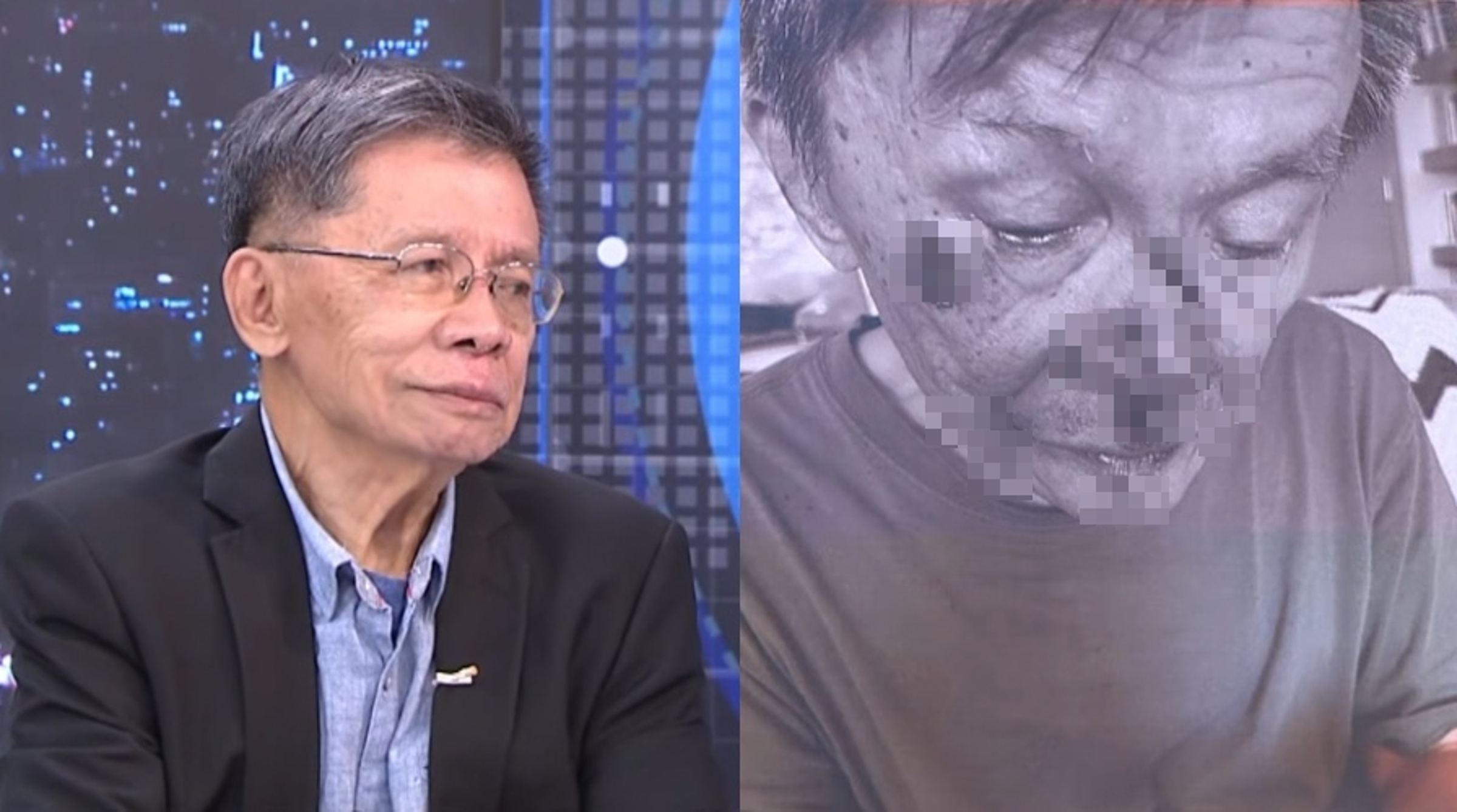 沈富雄日前因體力不支意外重摔導致臉部嚴重受傷，昨於政論節目《少康戰情室》公開滿臉是血的傷照，並透露因曾接受腎臟移植，跌倒時直覺用雙手保護腎臟才未骨折。（翻攝自youtube/
少康戰情室 TVBS Situation Room）