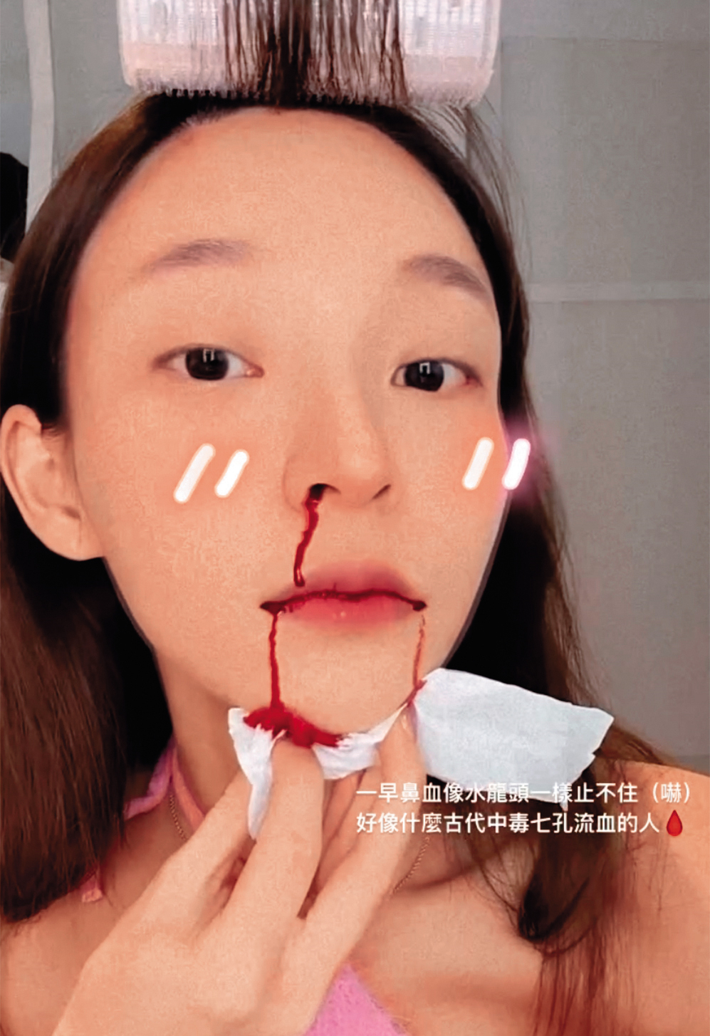 林襄鼻血直流,笑稱像古代中毒七孔流血的人。