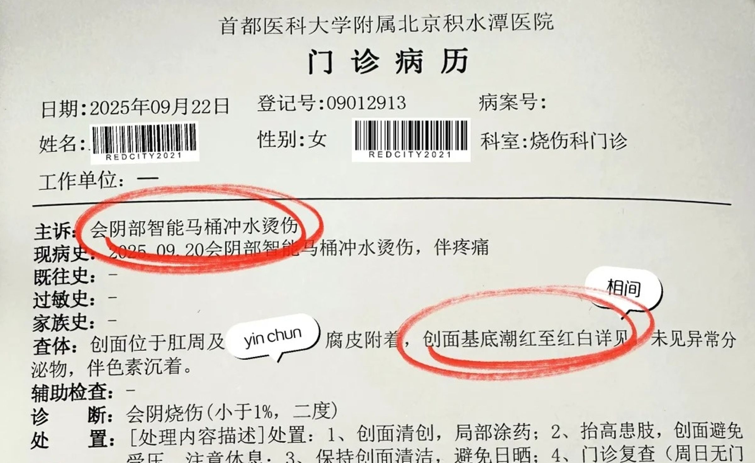 中國一名女子因使用免治馬桶而遭燙燒私密處。（翻攝網路）