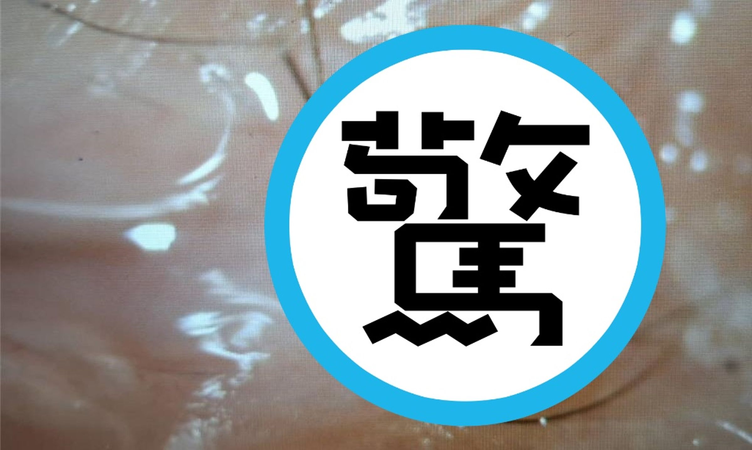 高雄一名8歲男童因左眼劇烈疼痛就醫,眼科醫師竟在患部發現一隻長達2.5毫米且仍在活動的活螞蟻。(洪啟庭提供)