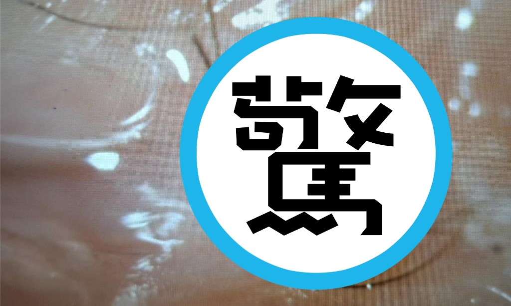 高雄一名8歲男童因左眼劇烈疼痛就醫，眼科醫師竟在患部發現一隻長達2.5毫米且仍在活動的活螞蟻。（洪啟庭提供）
