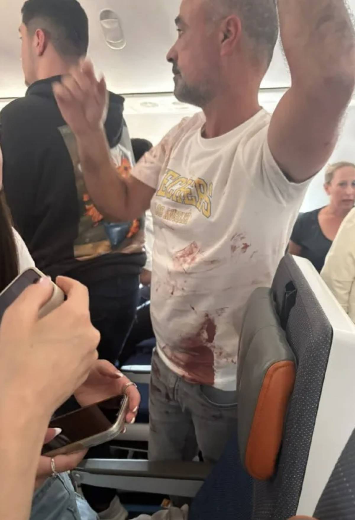 疑似為機師在機上發生暴力衝突,其中一名出面制止的乘客身上沾滿血跡。(翻攝X)