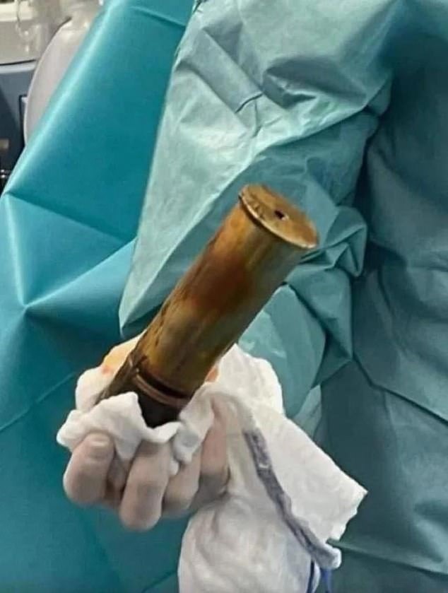 法國88歲阿公，下體塞入這顆砲彈。（翻自《每日郵報》）