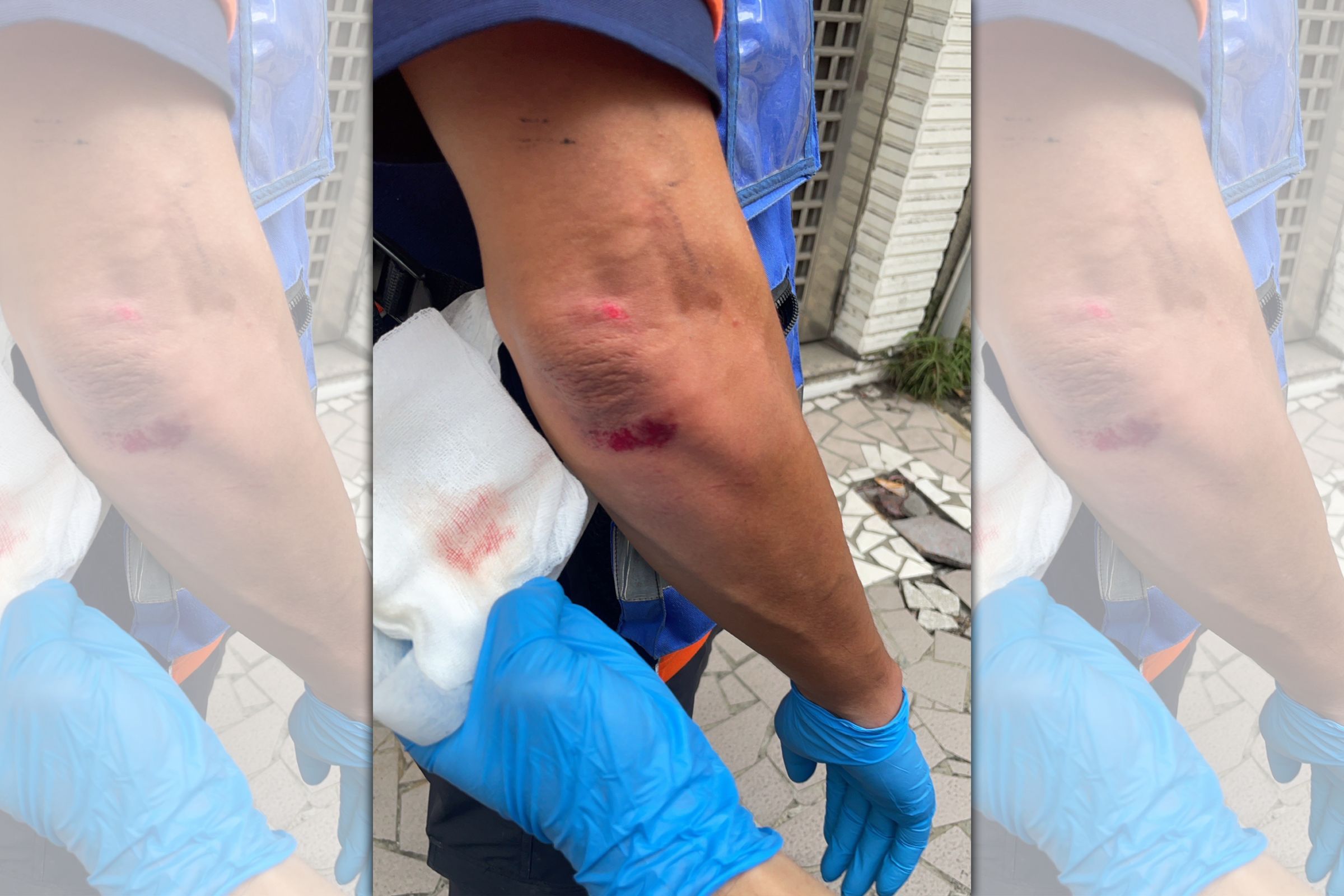 劉姓救護員出勤遭男子暴力攻擊,身上多處掛彩。(翻攝畫面)
