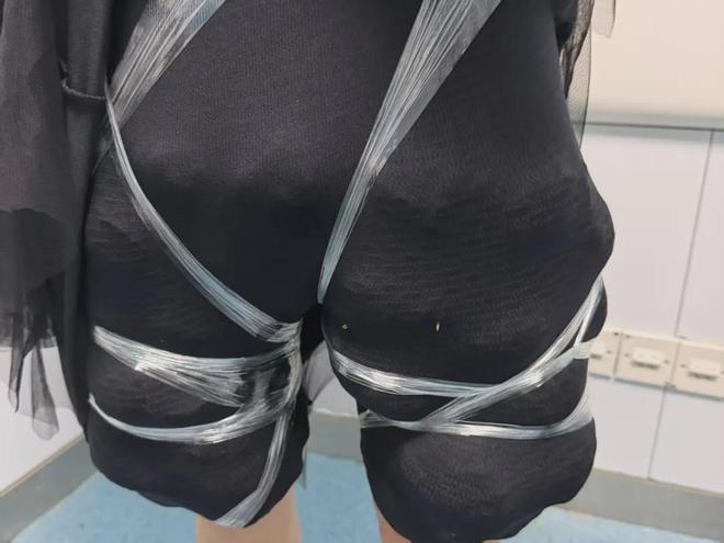 涉案女子雙腿密密麻麻全是活體陸龜,令人看傻眼。(翻攝自極目新聞)