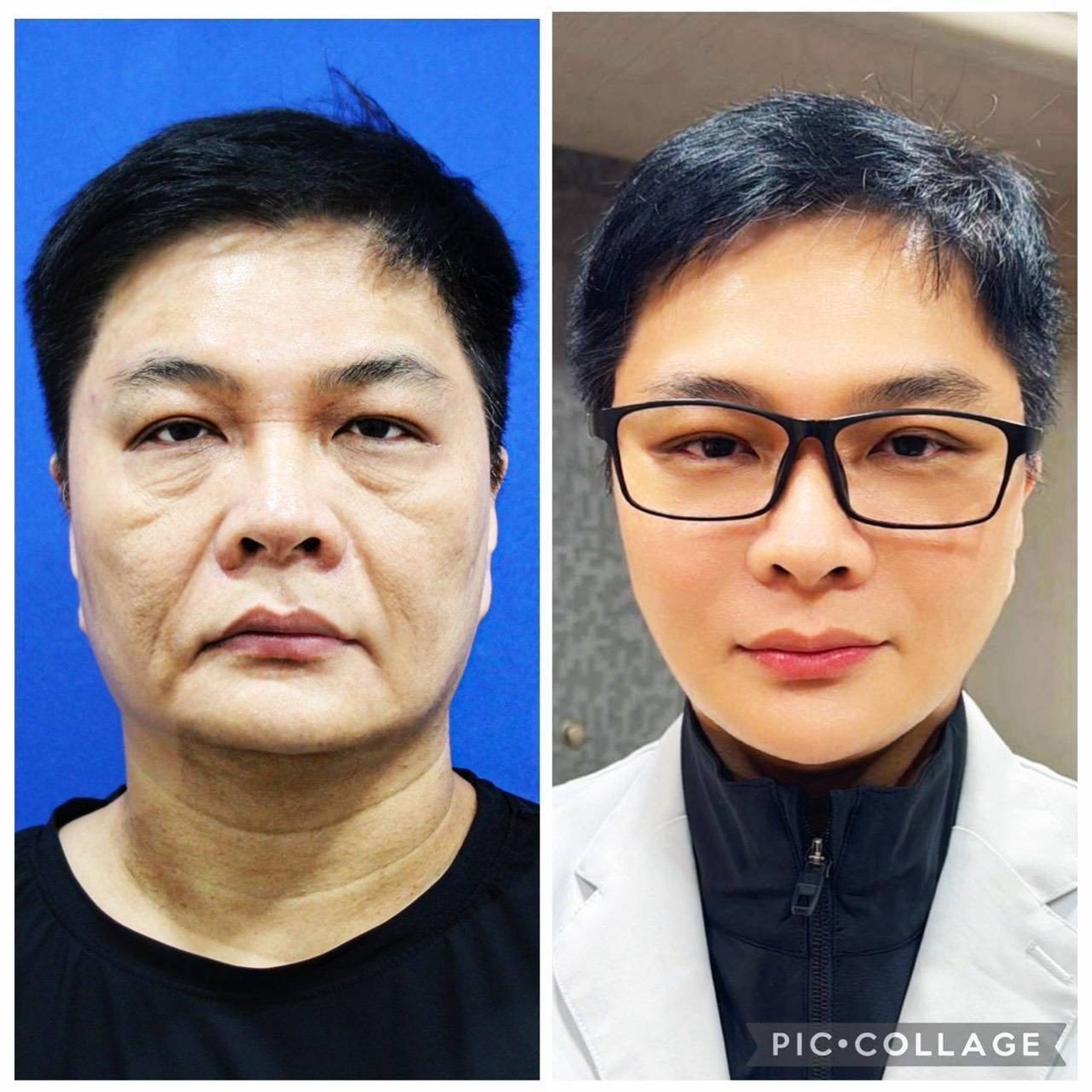 陳峙文之前被形容是「滄桑大叔」(左),現在則是帥氣型男(右)。(陽光璨亮生醫提供)