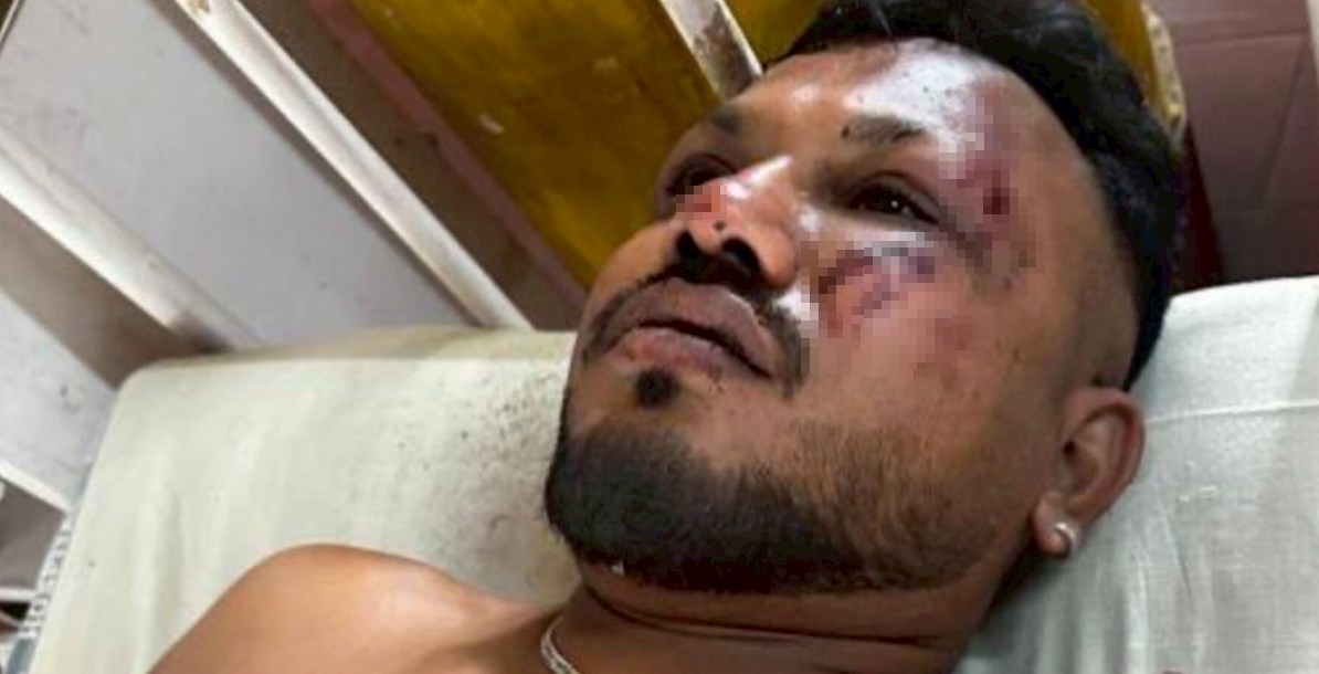 在這場墜機事故中，出現一名奇蹟生還者。（翻攝自X@DrNimoYadav）