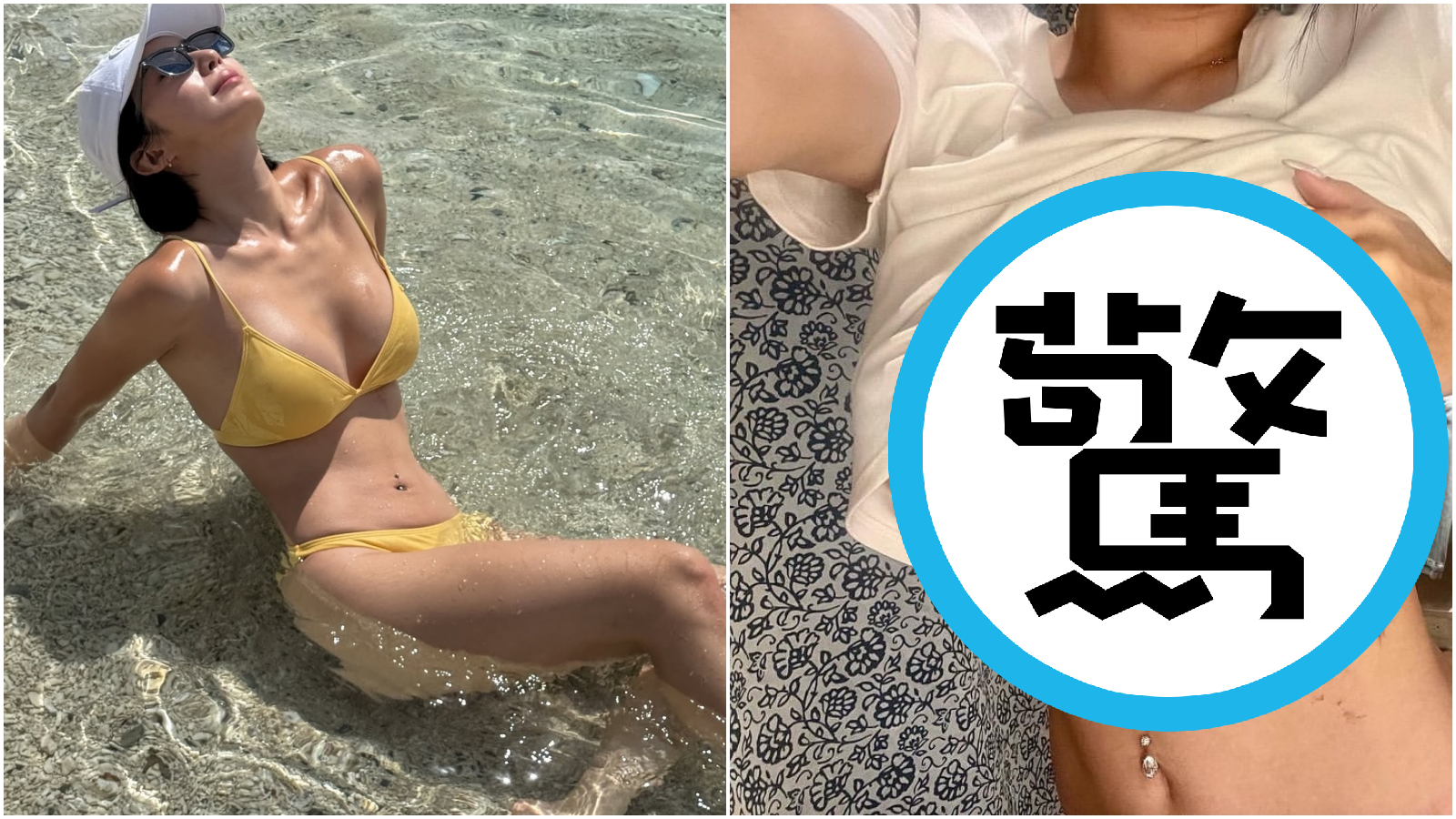 蘭嶼船潛出意外非首次，網紅Amber當年胸膛被螺旋槳打中鮮血直流，留下明顯疤痕。（翻攝Amber IG）