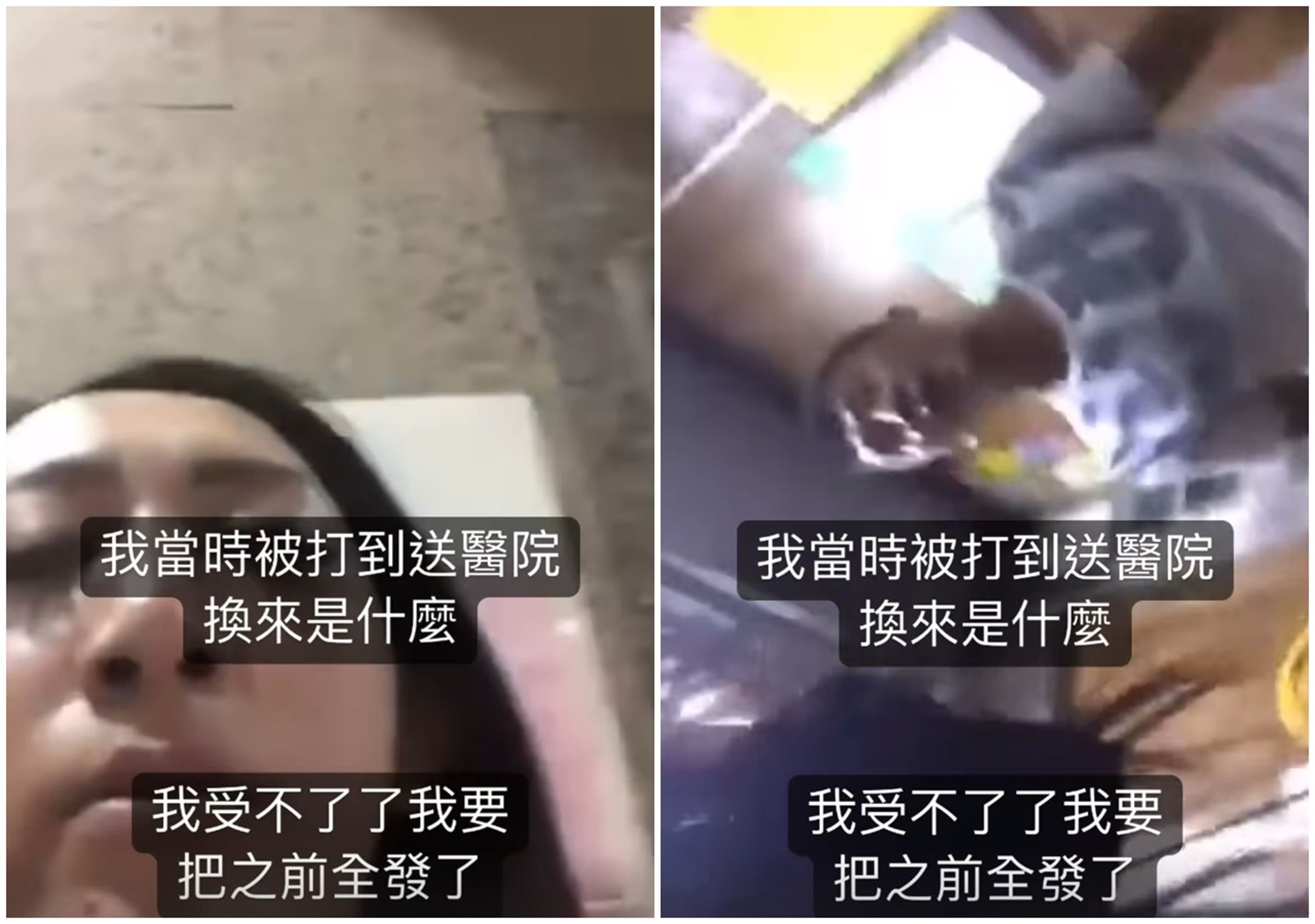 罔腰貼出過去遭鳳梨狂毆67秒的影片，還附上驗傷單直呼「我當時被打到送醫院，換來是什麼」。（翻攝自罔腰IG）