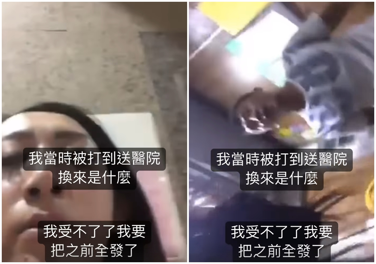 罔腰貼出過去遭鳳梨狂毆67秒的影片，還附上驗傷單直呼「我當時被打到送醫院，換來是什麼」。（翻攝自罔腰IG）
