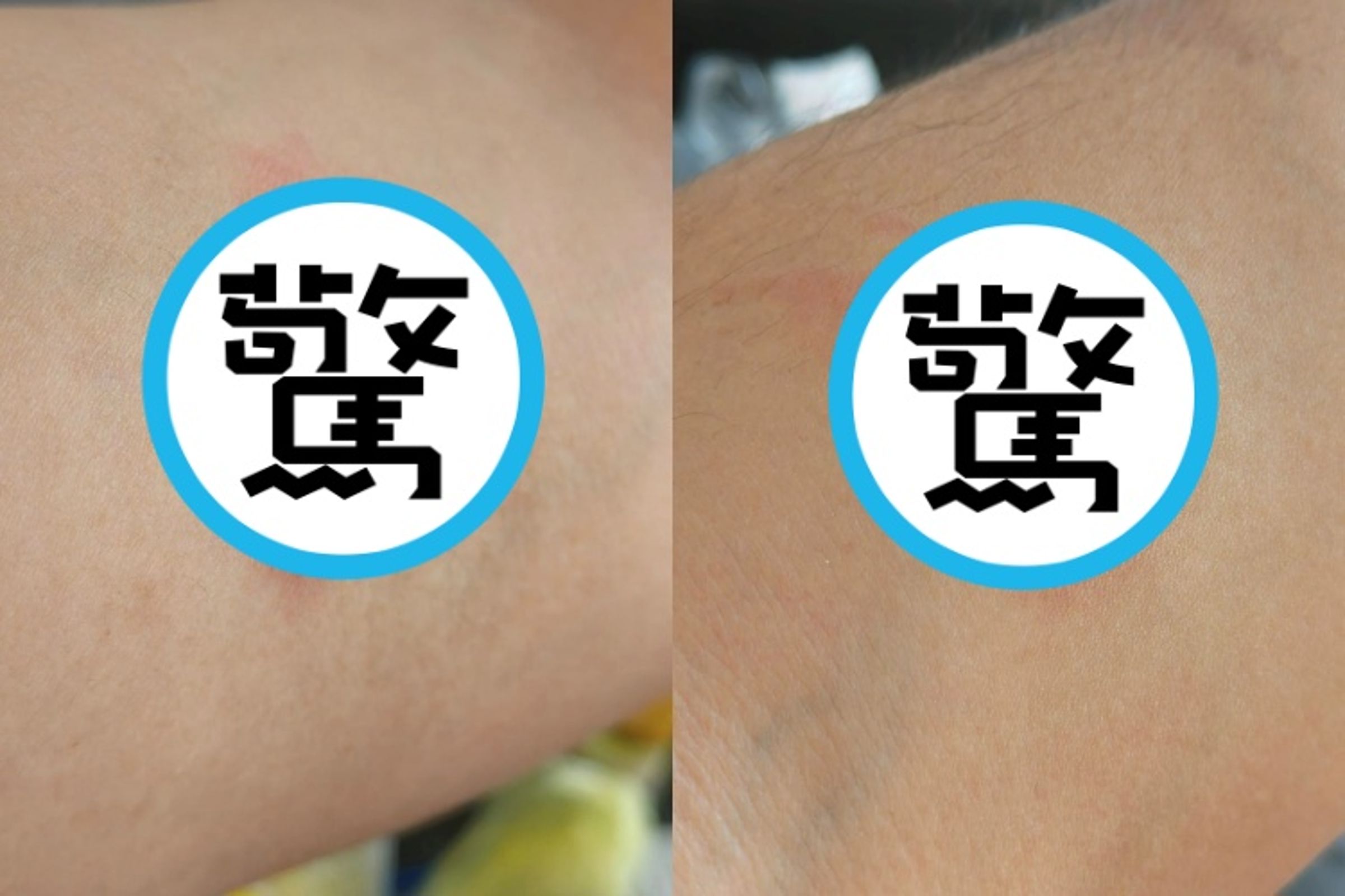 一名網友分享,洗車的時候被「蜘蛛」鑽進袖子裡叮咬。(翻攝自報廢1公社)