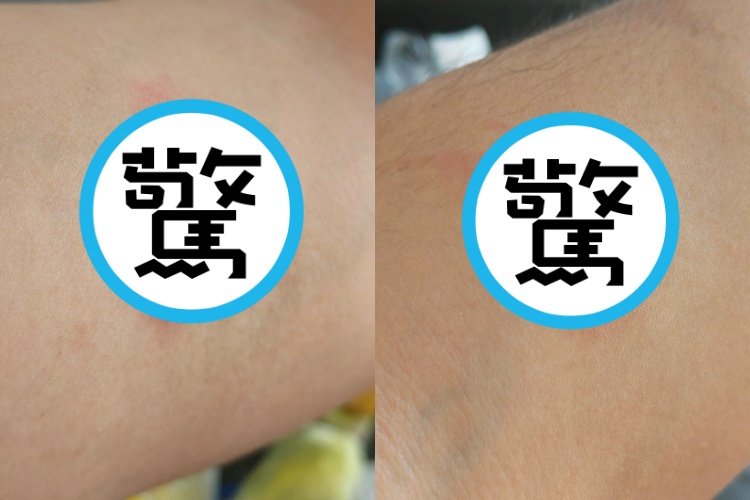 一名網友分享，洗車的時候被「蜘蛛」鑽進袖子裡叮咬。（翻攝自報廢1公社）