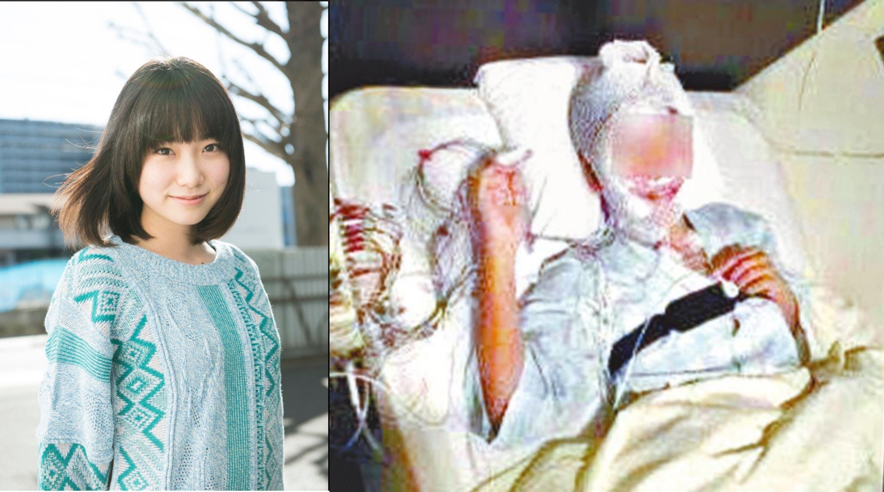日本女偶像富田真由在2016年遭粉絲狂刺20多刀，臉部毀容且留下後遺症，她在法庭上大吼：「希望他去死。」（網路圖片）