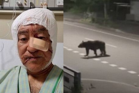 湊屋啓二前年在自宅車庫遭遇潛伏的熊，至今仍飽受傷口疼痛折磨。熊為示意圖（翻攝自NHK）