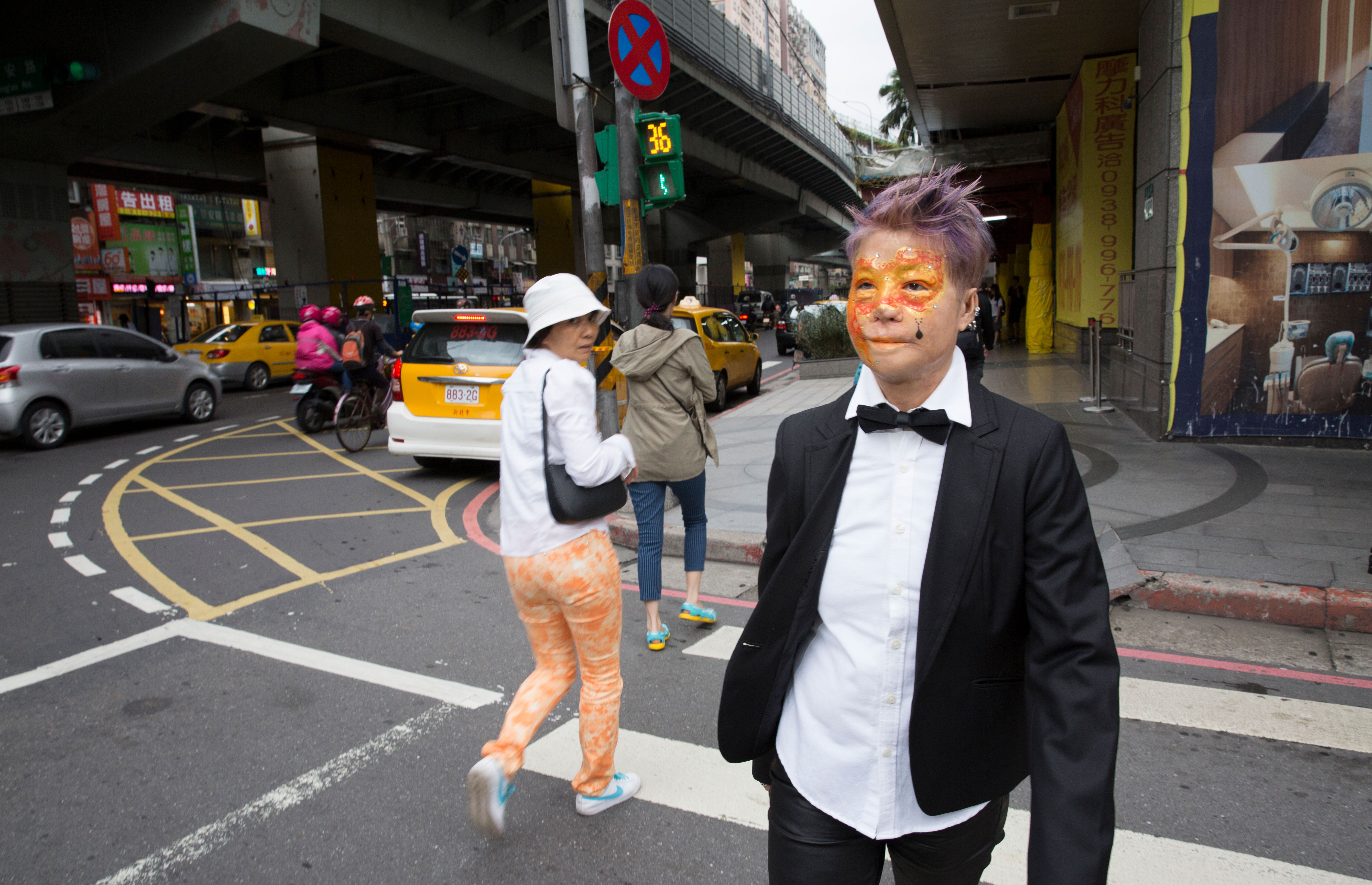 【鏡相人間】美麗的臉　海霸王大火倖存者的重生路