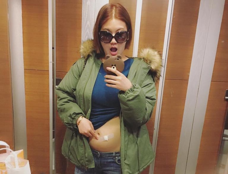 39歲宋新妮小產後不放棄　打排卵針拚生子