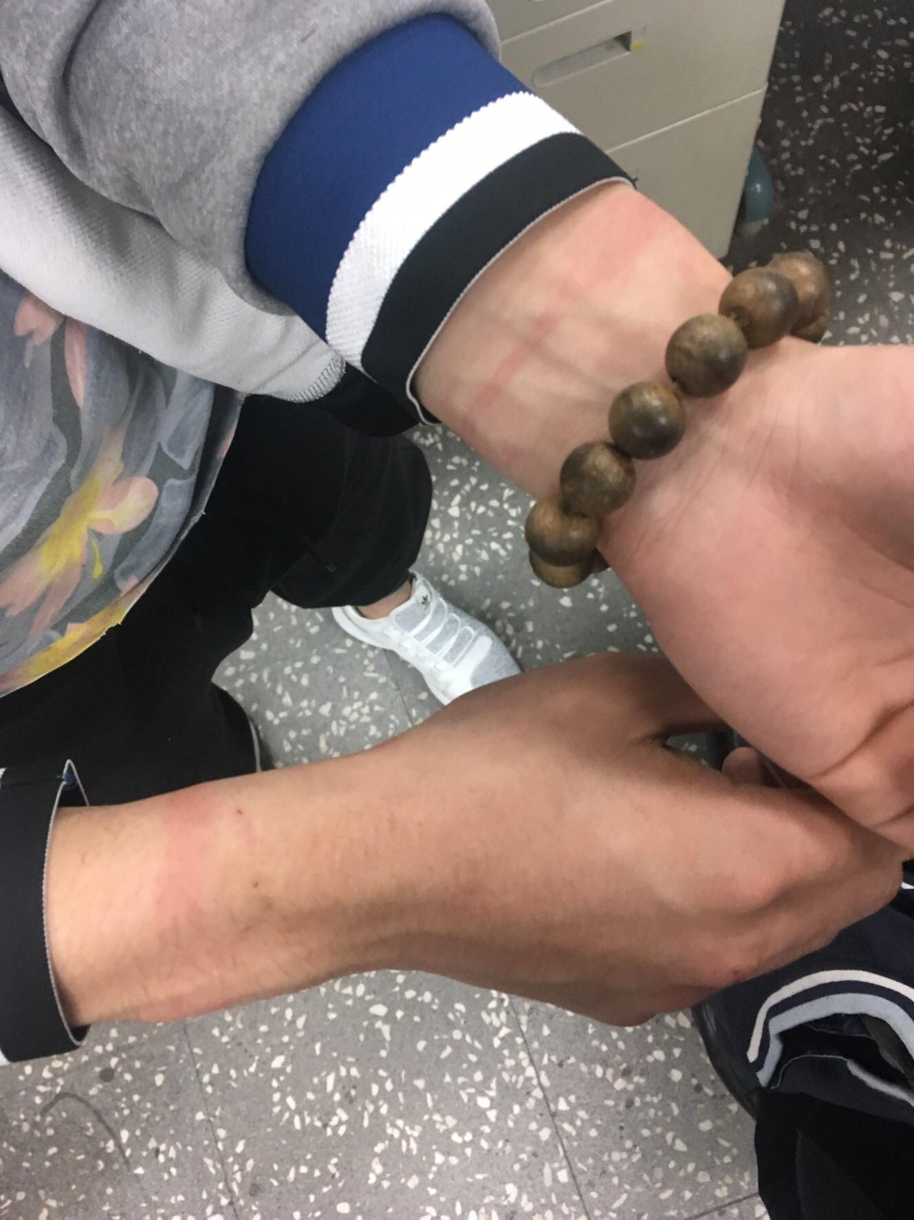 受害者李男遭塑膠束繩綑綁，手留下遭綁痕跡。