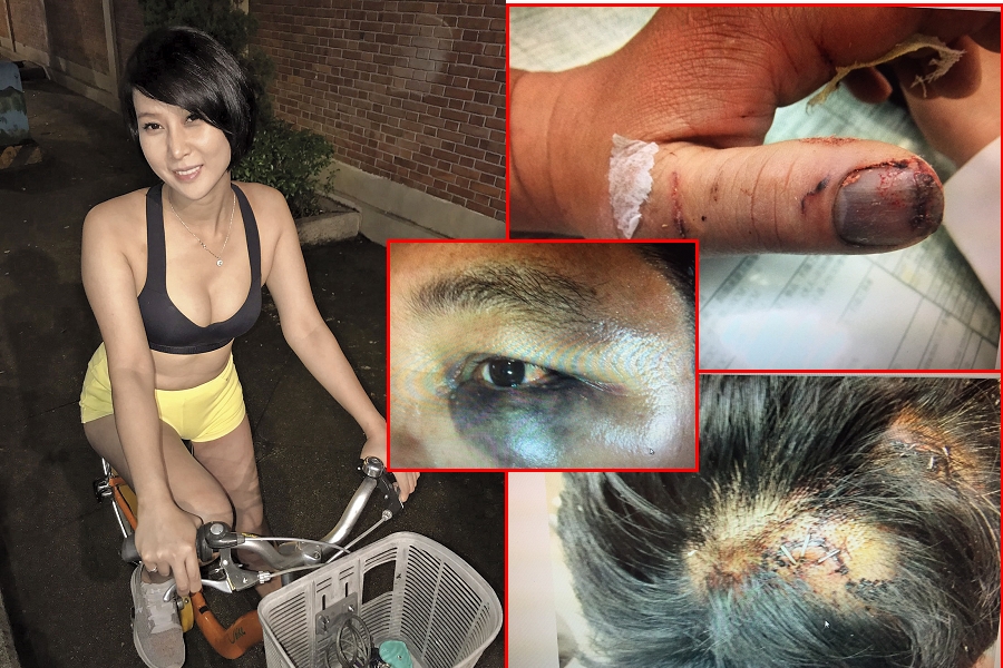 【童邱戀桃花劫】回應傷害前科　邱主任說話了