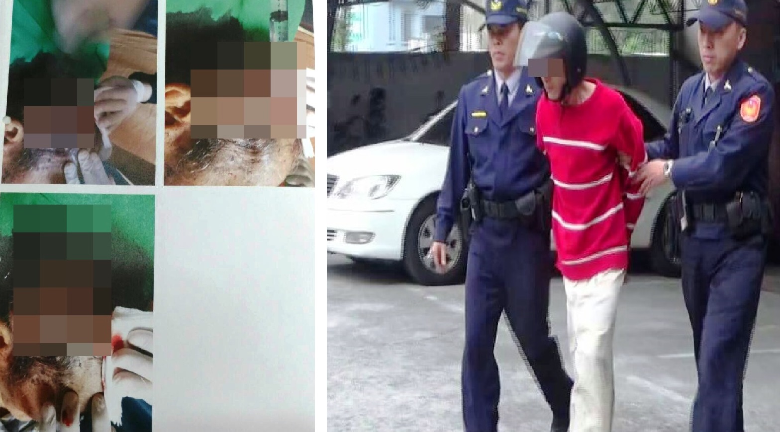 老翁莫名遭砍多刀，傷勢嚴重，頭部皮開肉綻（圖左）。莊嫌自稱有妄想症，砍人落網後還不知悔悟（圖右）